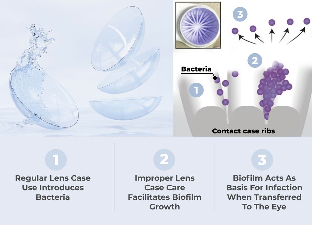 Poor Hygiene Results in Eye Infections