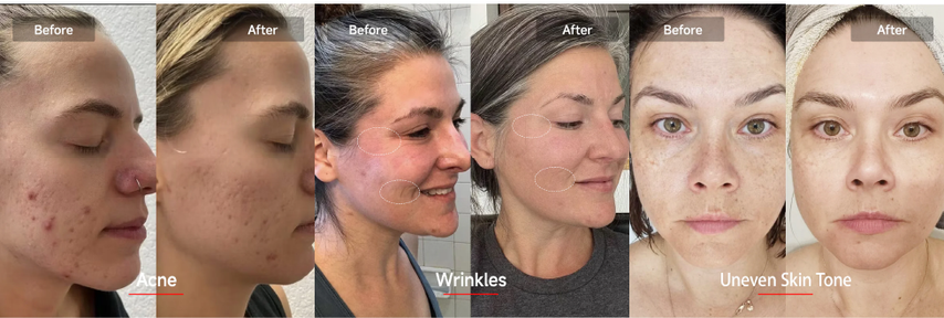 Say Goodbye To Wrinkles and Breakouts